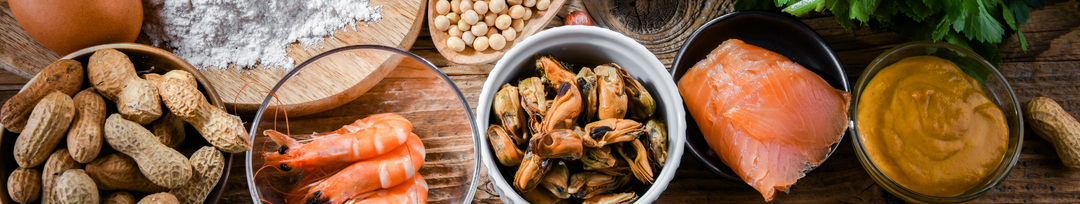 Banner is a photo of fool allergens including monkey nuts, prawns, mussels, raw salmon, and mustard